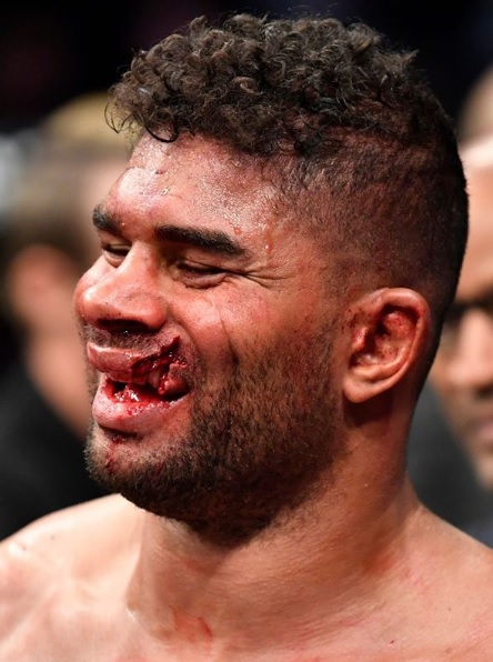Alistair Overeem